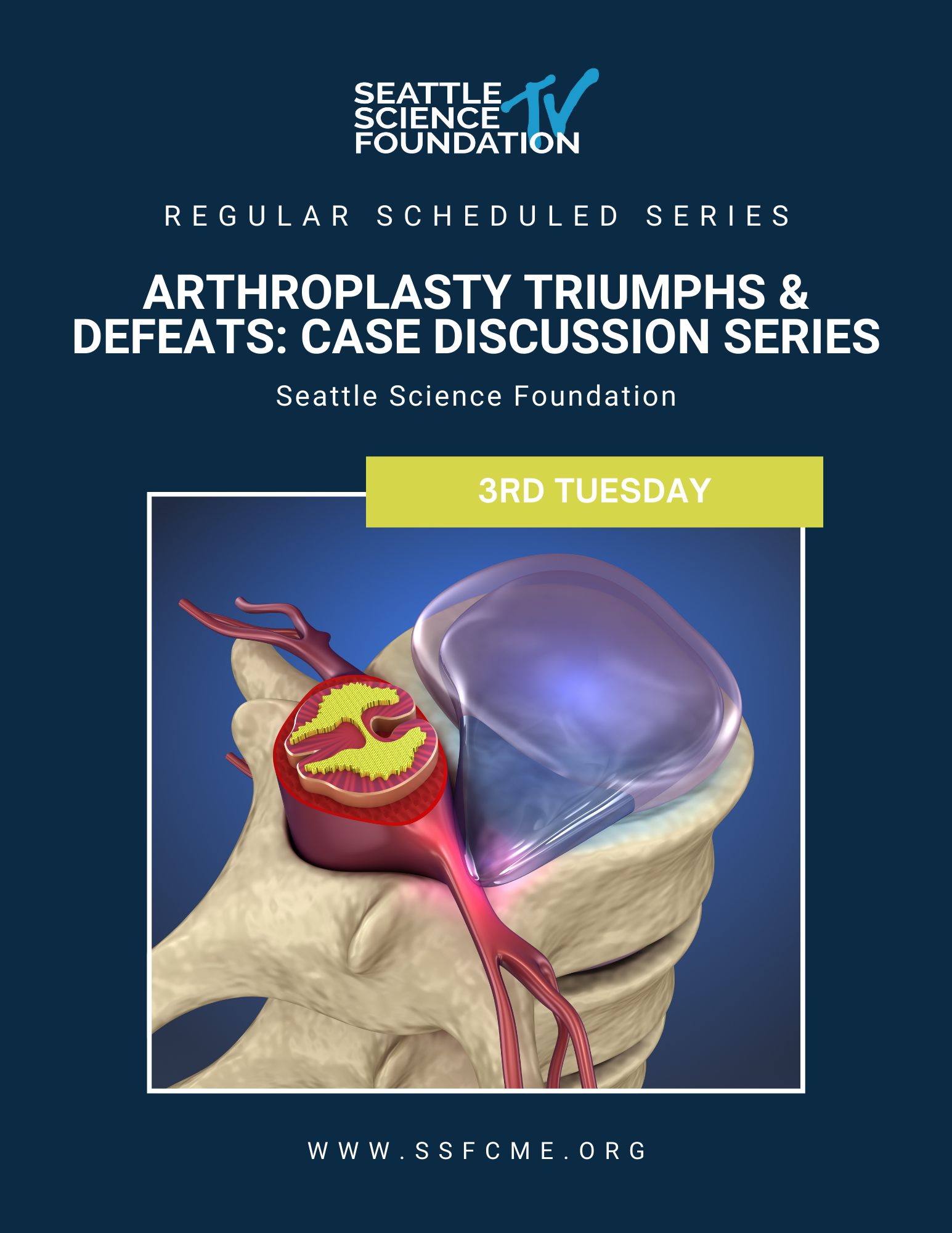 Spine Arthroplasty Triumphs & Defeats Case Discussion Series 2022 Banner